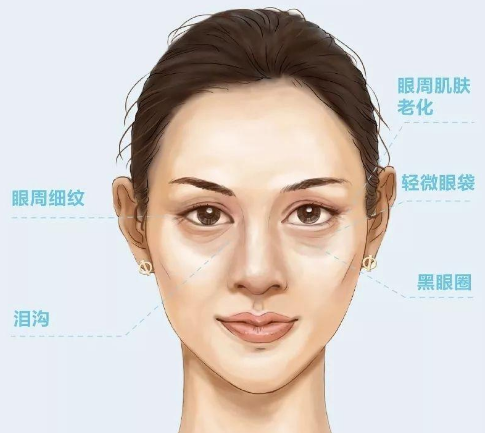 眼周细纹----------30-45岁黑眼圈-------------28-30岁测测你的眼睛
