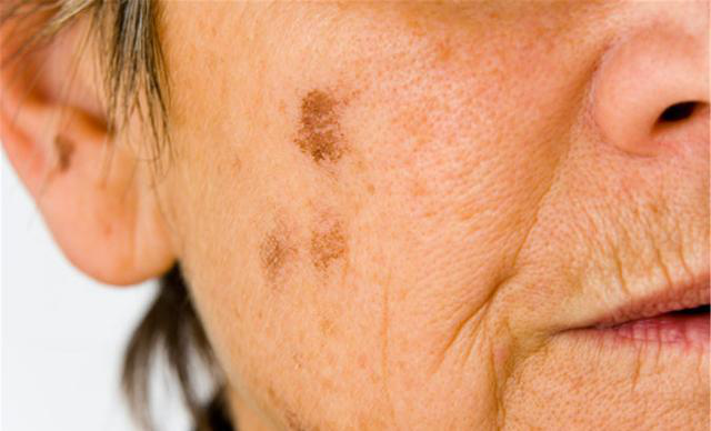 据说欧美人的皮肤老化速度比亚洲人快,根据衰老指标显示,皮肤颜色越深