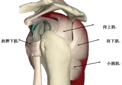 肩膀疼痛无小事,莫把肩周炎拖成"冻结肩"!