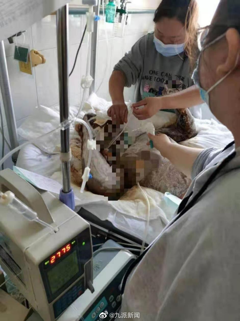河南男子泼汽油烧伤女友受害者妹妹：他扬言没有分手只有丧偶_凤凰网