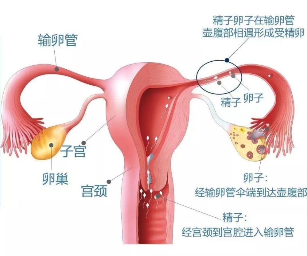 同性在哪代孕（预告丨做试管婴儿前，必须知道的6个真相）