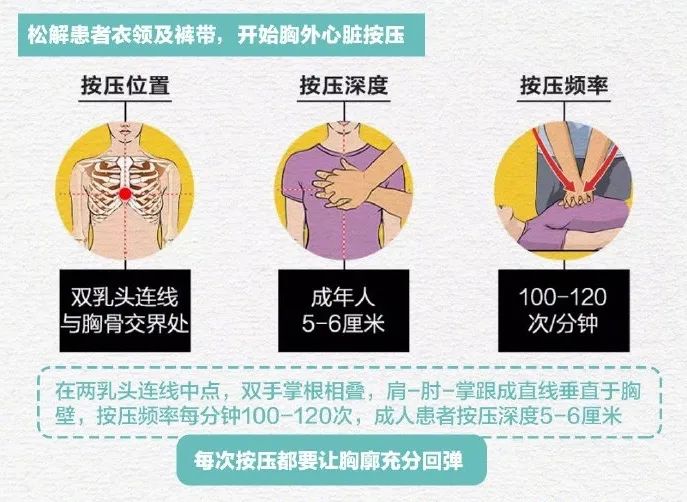 那个心脏骤停倒在北京地铁的人 终于用上了aed