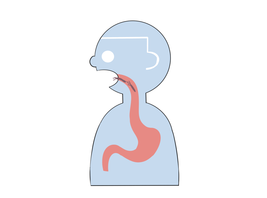 传播幽门螺杆菌,全在这4个动作里!__凤凰网