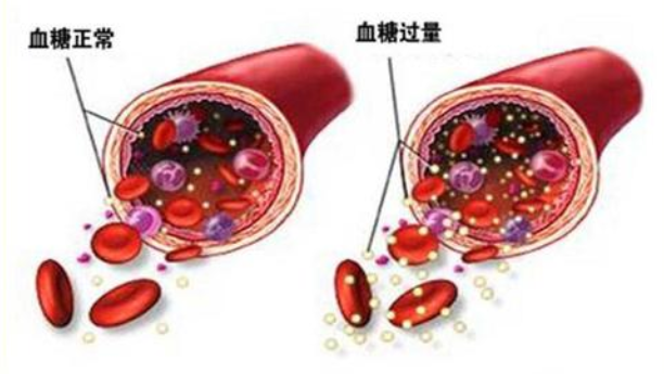 血糖高,当心是血管出现了问题__凤凰网