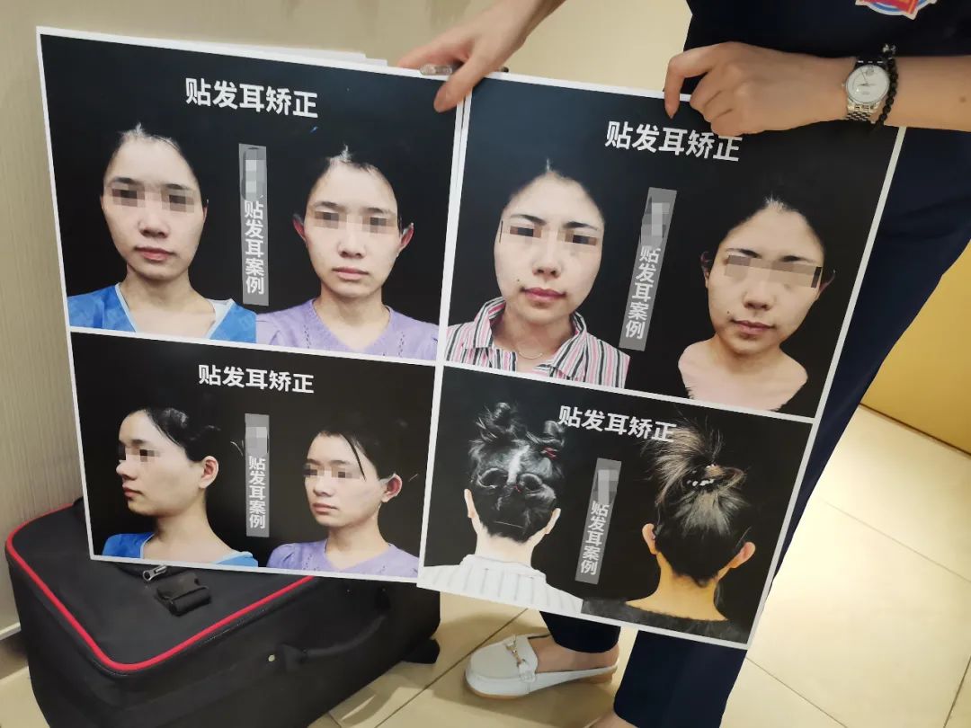 手术床多少钱精灵耳走红失败 医美的钱开始难赚了_https://www.jmylbn.com_品牌排行榜_第5张