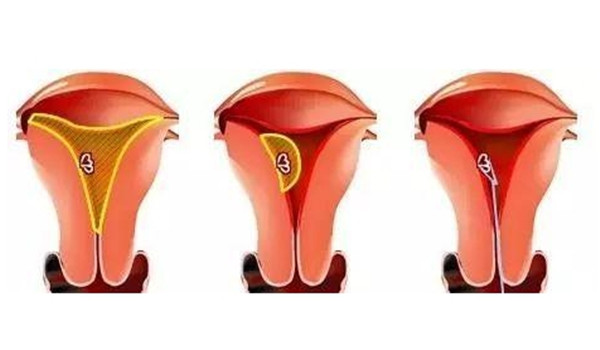 子宫内膜有哪些周期性变化?对我们生育有哪些意义__凤凰网