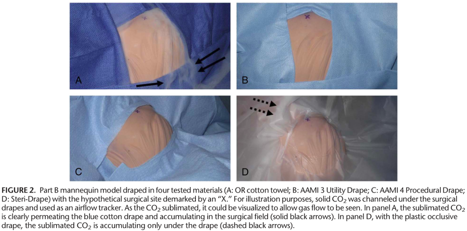 为什么手术用电刀患者痔疮手术中放了个屁，居然引发一场火灾_https://www.jmylbn.com_新闻资讯_第5张