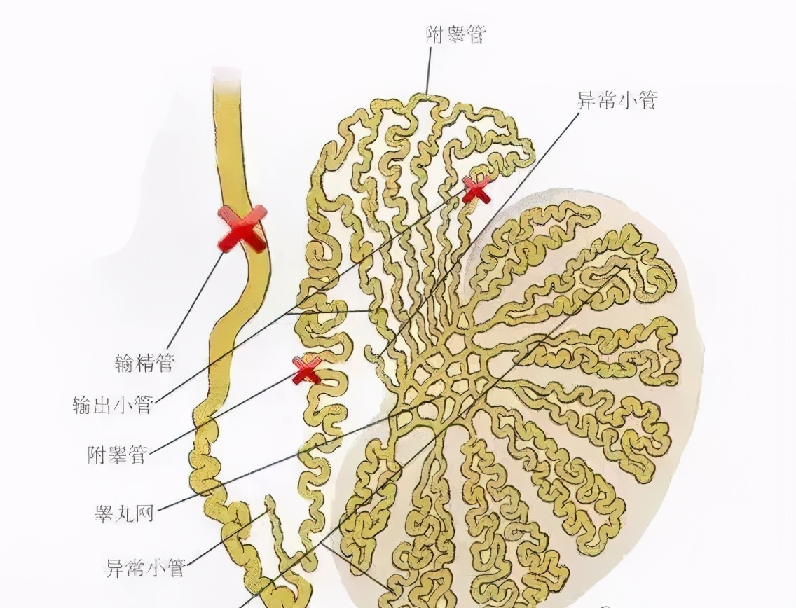 还是手术?__凤凰网