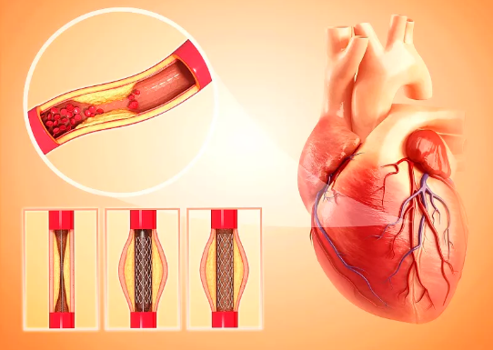 心脏神经官能症与心脏病有何区别?听听王世龙中医师的看法__凤凰网