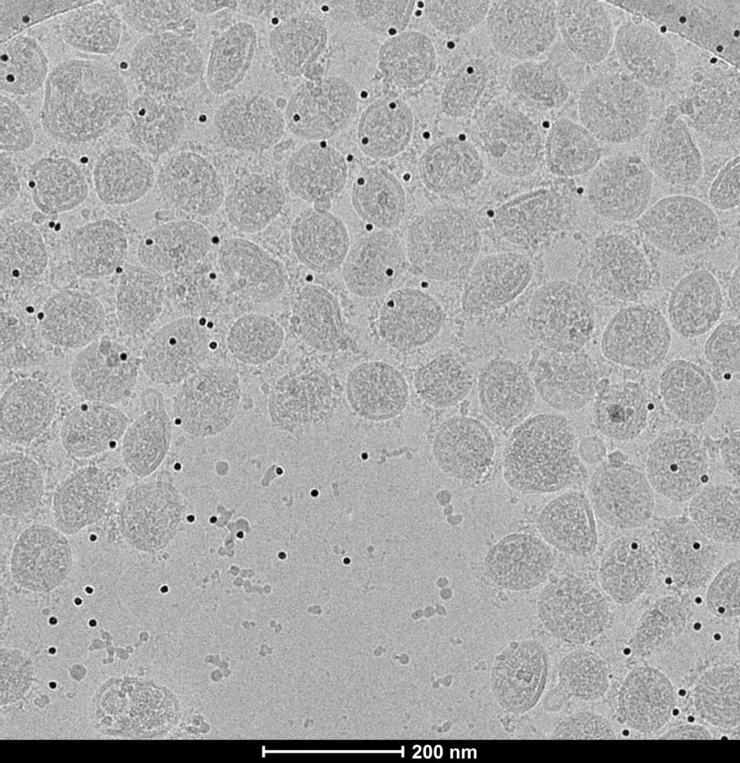 经多聚甲醛灭活后的新冠病毒冷冻电镜图片（李赛实验室供图）
