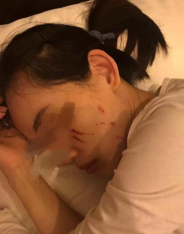 远嫁澳洲的女同学被家暴!想回国避难,但又不放弃澳籍