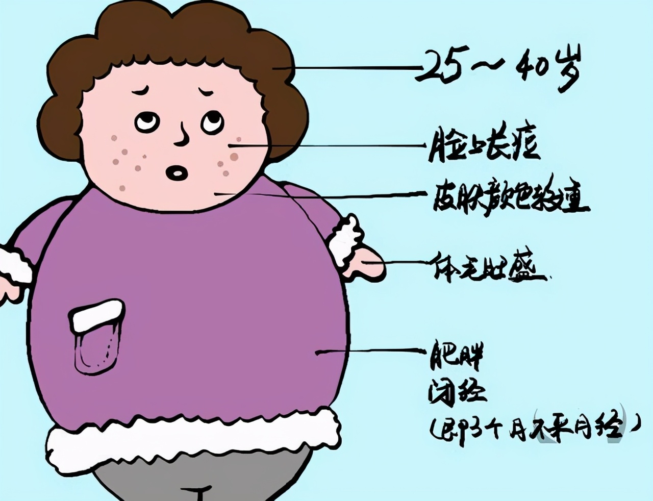 患上多囊卵巢综合征,有哪些症状表现?