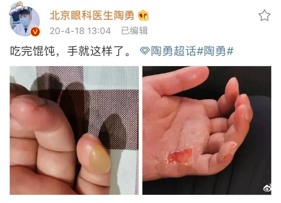 做康复训练中的陶勇 因为这次伤医事件,大量的关注涌向陶勇.