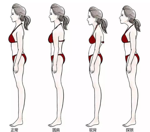 驼背,探颈和圆肩影响气质怎么办?加入针对性动作,改善不良体态