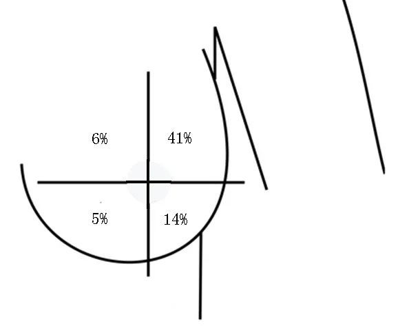 女性必读,乳房自检你会吗?