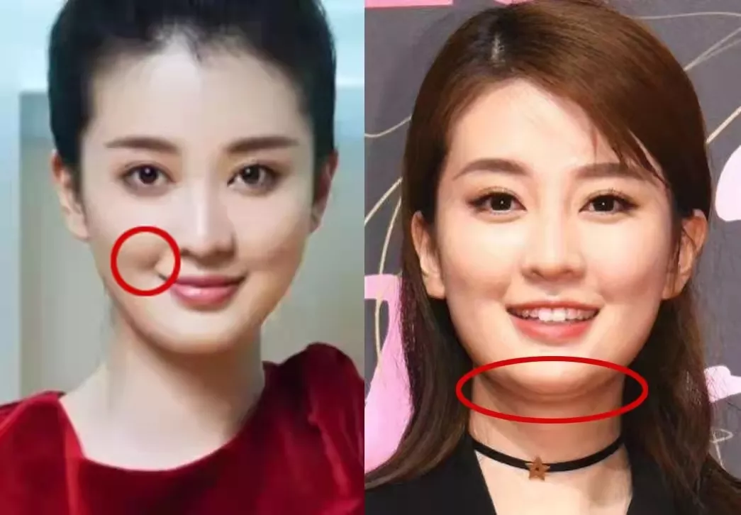 看乔欣的这张正面照,她本身的骨骼走向是很好的,但肌肉乏力导致腿部