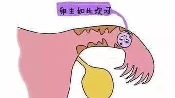 成都借卵助孕（医生，我输卵管堵塞只能做试管吗？有没有别的办法？）