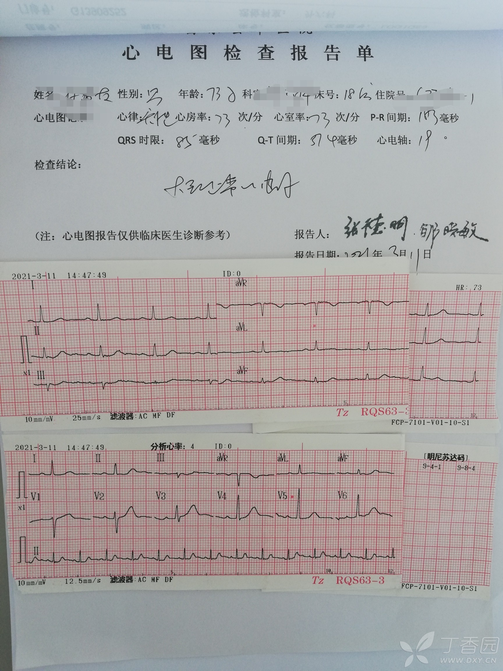 心肌梗塞的报告图片图片