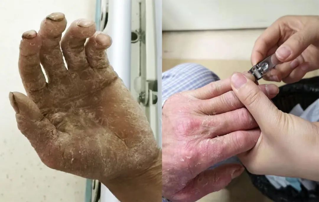 暖哭!90后女护士用腿给老奶奶当椅子,瘦弱身躯支撑10分钟