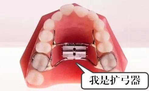 扩弓