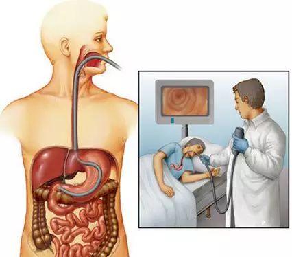 做胃镜就做胃镜,为什么做之前还要我抽血和做心电图检查?
