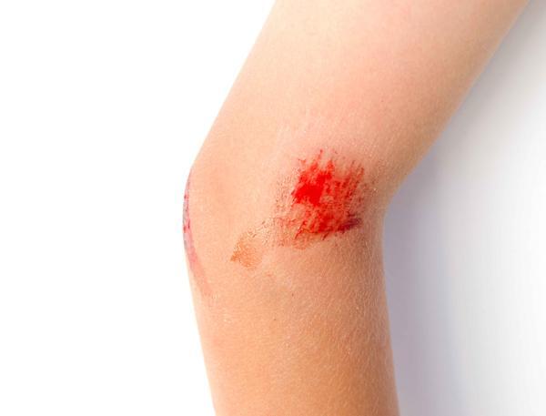 糖尿病u201c找上门u201d时，身体这5种症状u201c藏不住u201d，若你有需重视