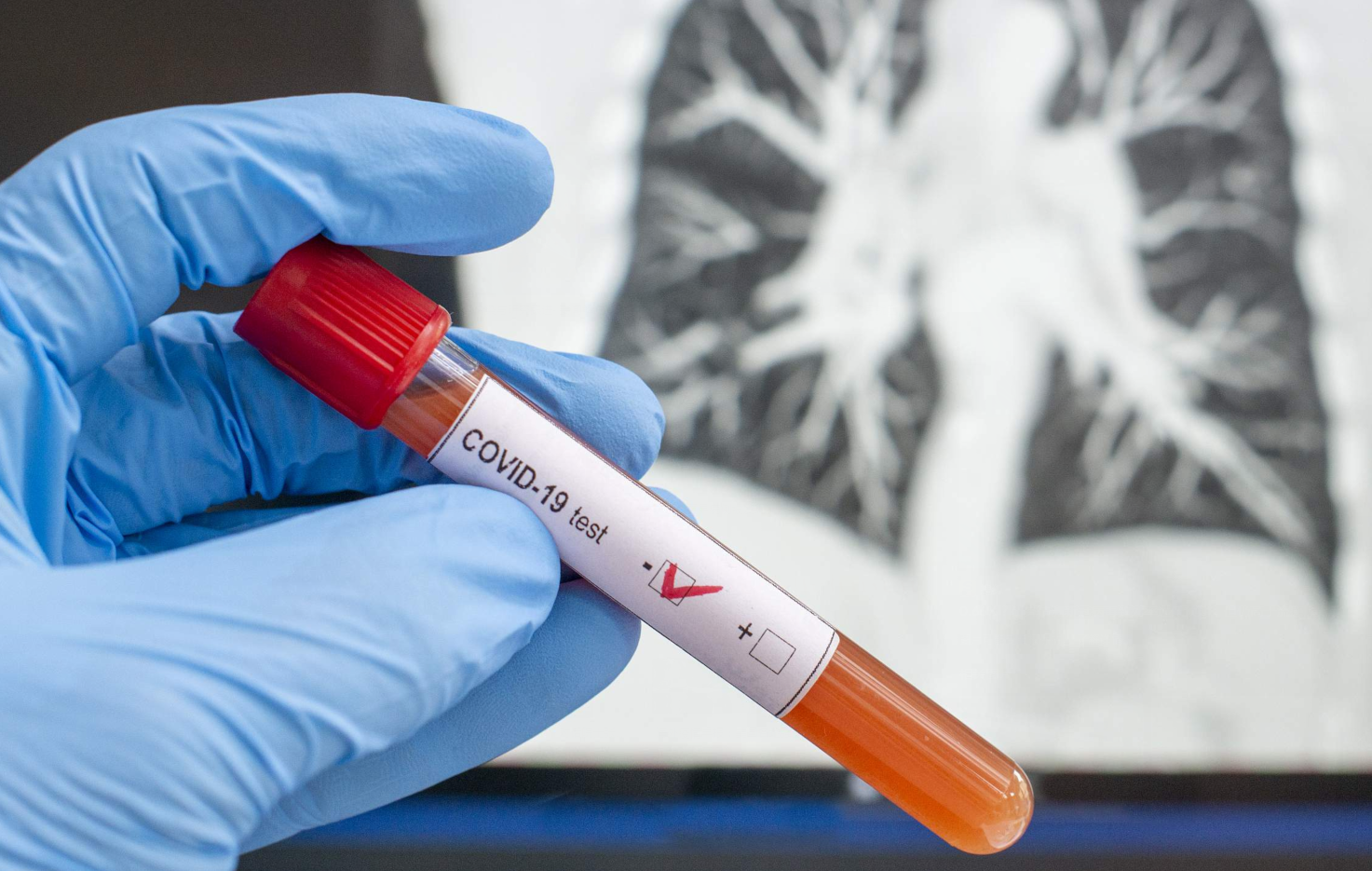 重磅消息欧洲发现新冠病毒源自美国所有证据直指德特里克堡