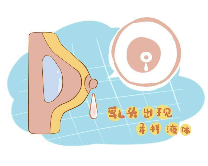 3,乳房腫塊