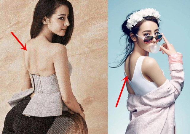 女生盲目追求的蝴蝶背看起来美实则是畸形审美影响健康