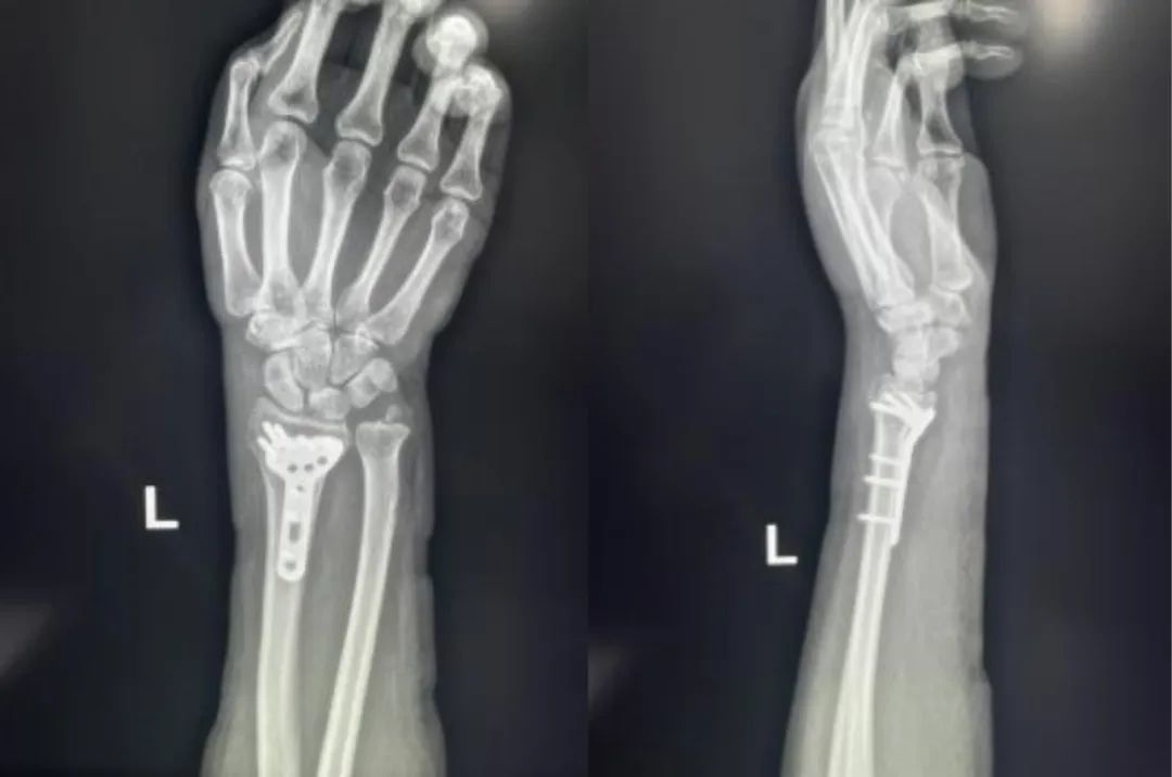 何が原因でしょうか?