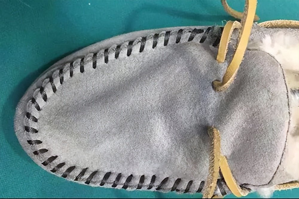 现在海象就给大家分享下磨砂皮鞋的处理方法:首先,我们要知道这个鞋子