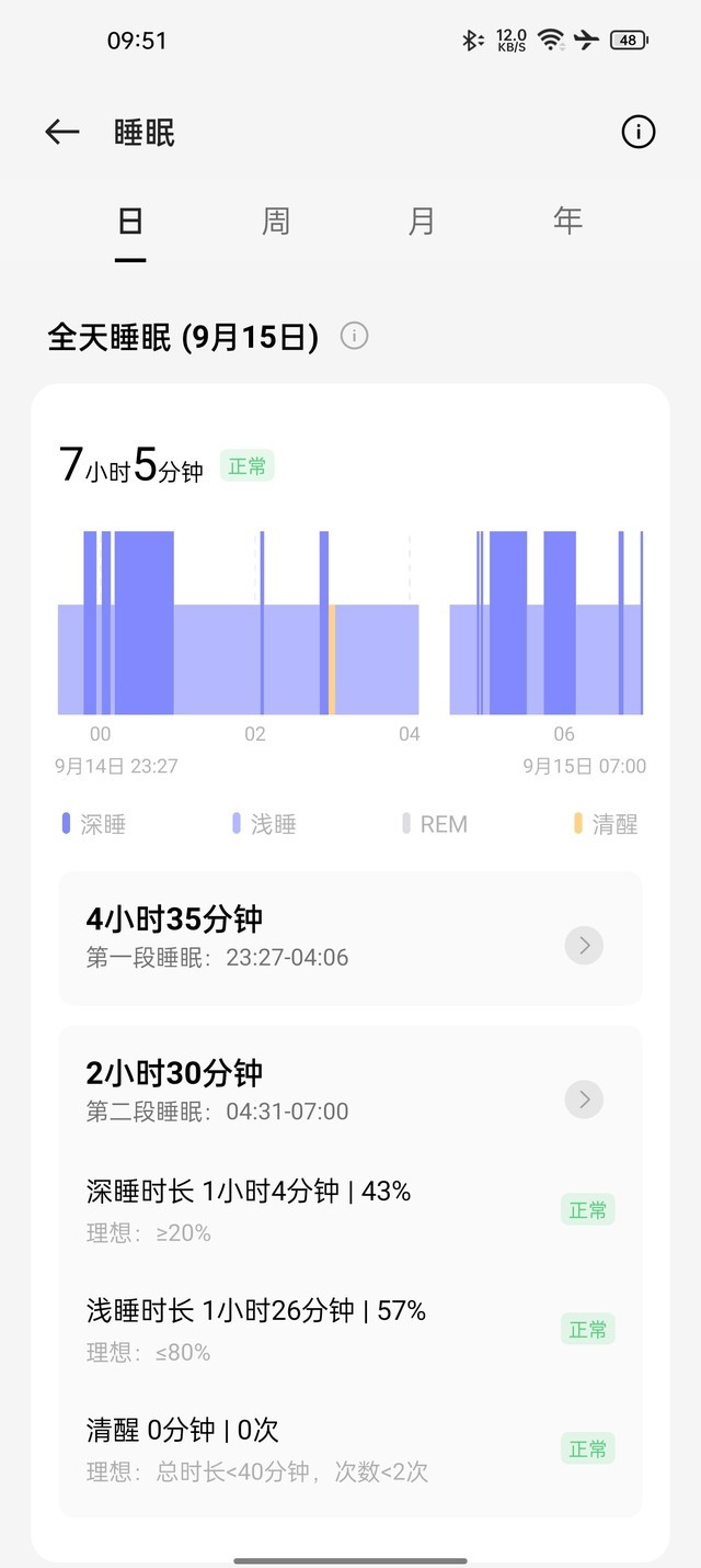 在家就能做心电检测 OPPO Watch 2 ECG版评测(待审)