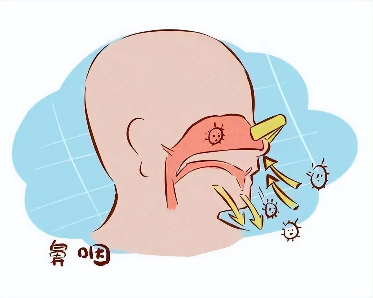 鼻前庭炎,可由于鼻炎,鼻窦炎,肿瘤等引起?应积极促使炎症消退