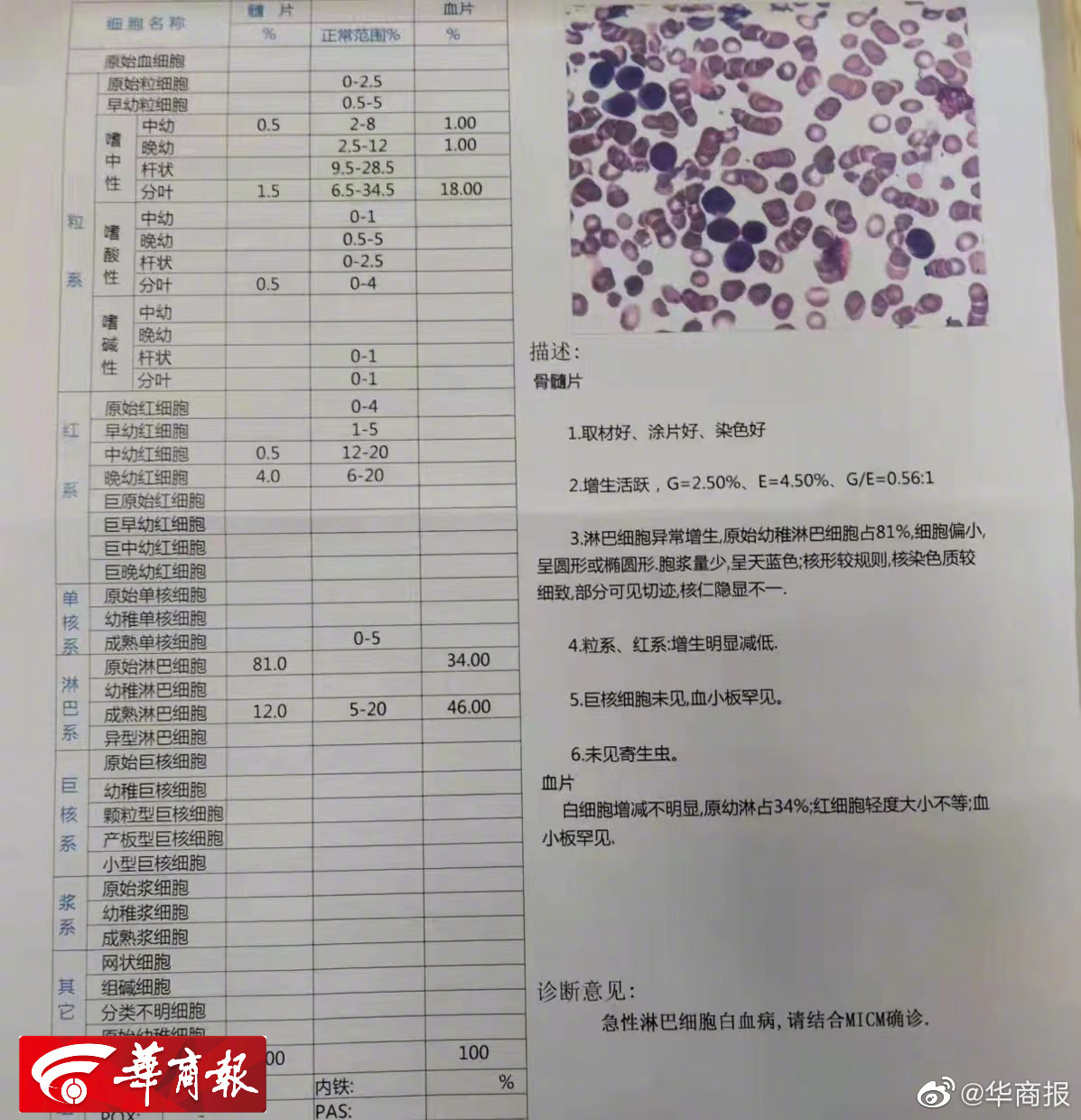 西安7岁白血病患者因疫情断疗1周 现已被收治