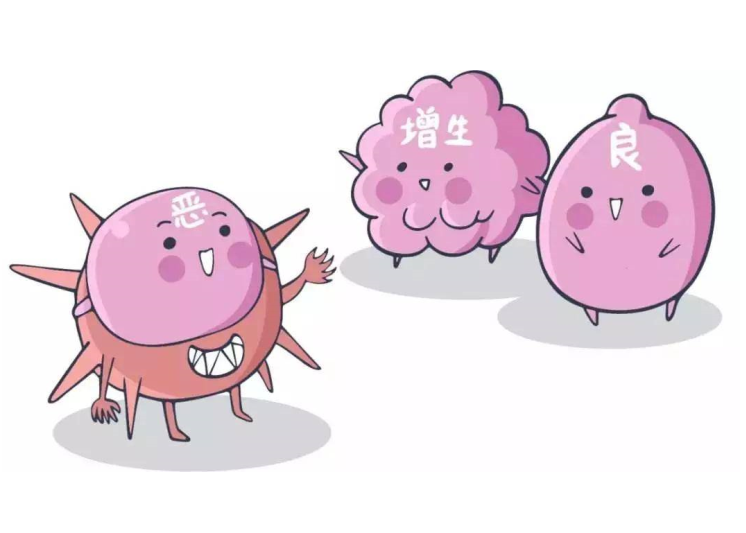 乳腺结节边界明显多为良性肿瘤