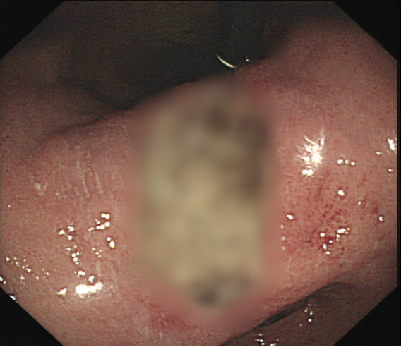 28D6CDF6222CD710C770C3BDF53365E9654E4988_size408_w568_h492.png