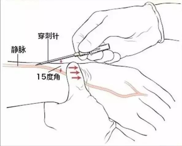 常见临床操作图解