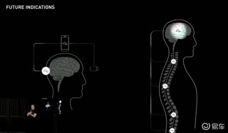 马斯克：预计脑机接口公司Neuralink将在6个月内开始人体试验_凤凰网汽车_凤凰网