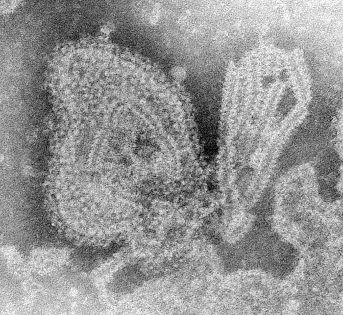 腮腺炎病毒（图源：CDC）
