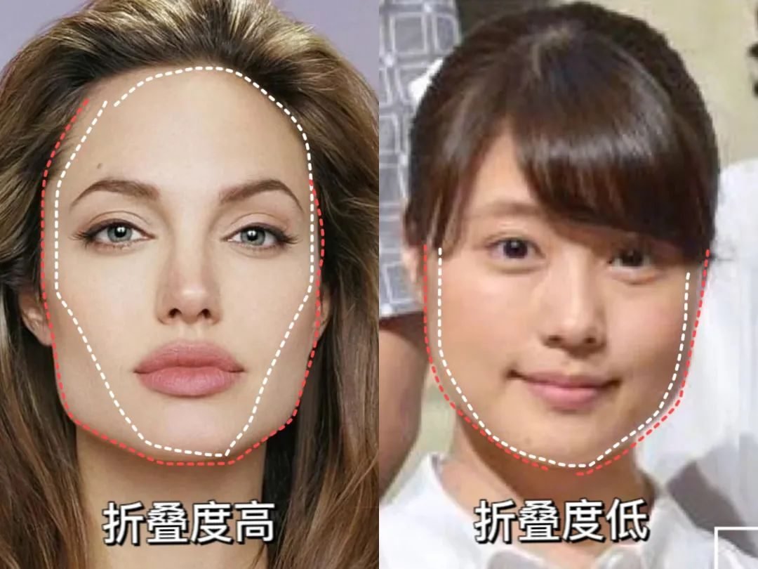 单眼皮、泪沟、凸嘴、方腮等,才是“小美女”的重中之重_凤凰网