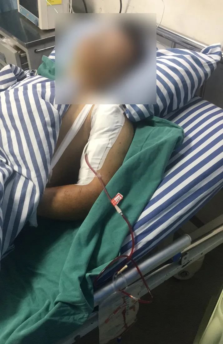 △杨光银在医院接受治疗