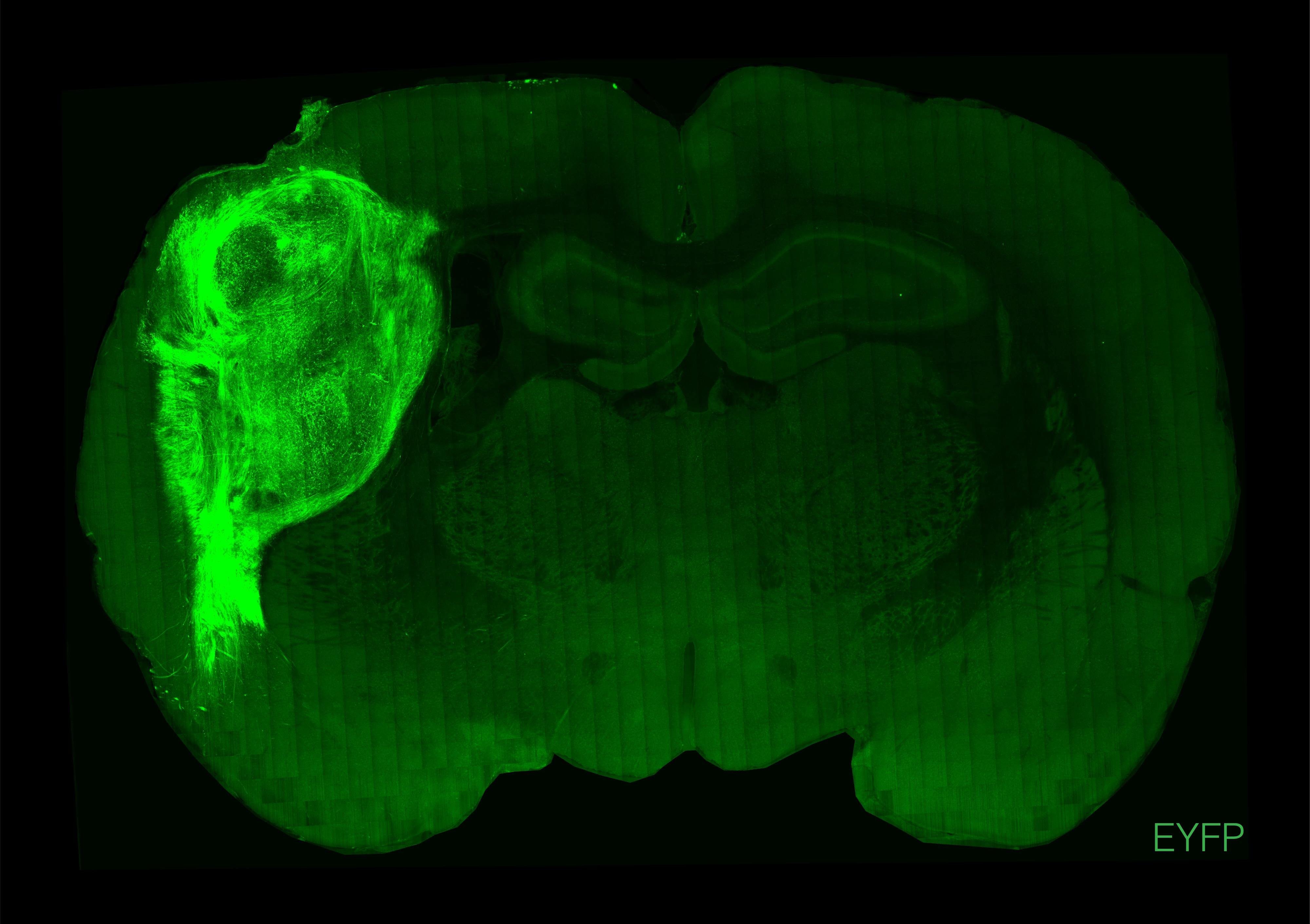 一个用荧光蛋白标记的人类类脑在大鼠的大脑中。图片来源于斯坦福大学。