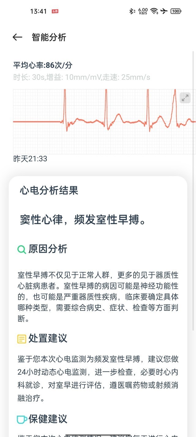 在家就能做心电检测 OPPO Watch 2 ECG版评测(待审)