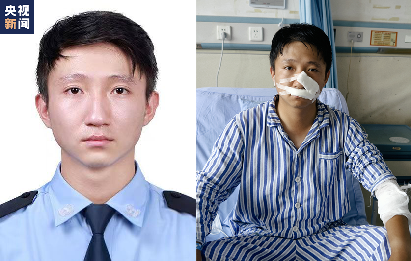 △符杰(左为受伤前,右为受伤后)