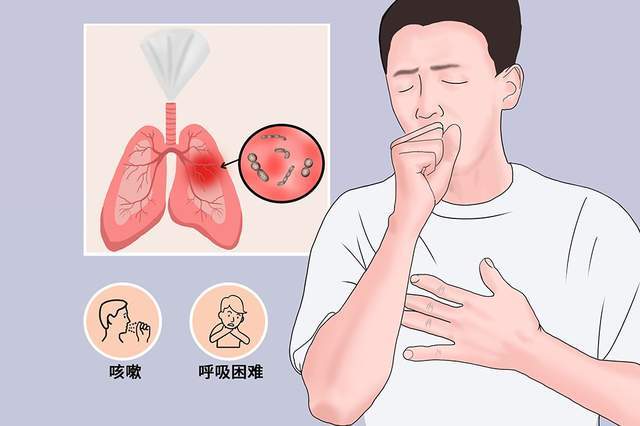 尘肺病 漫画图片
