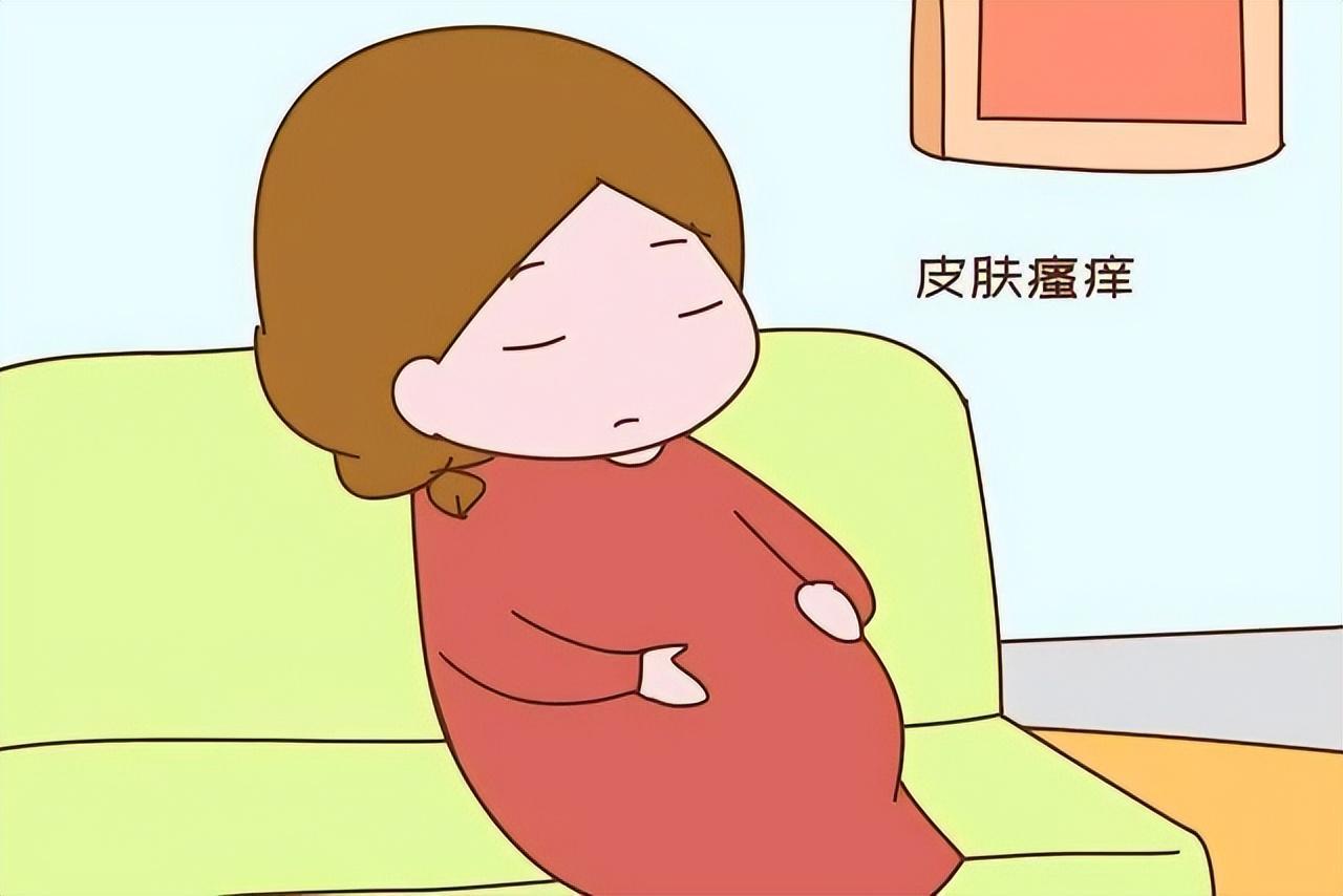 孕妇胆汁淤积症状图片图片