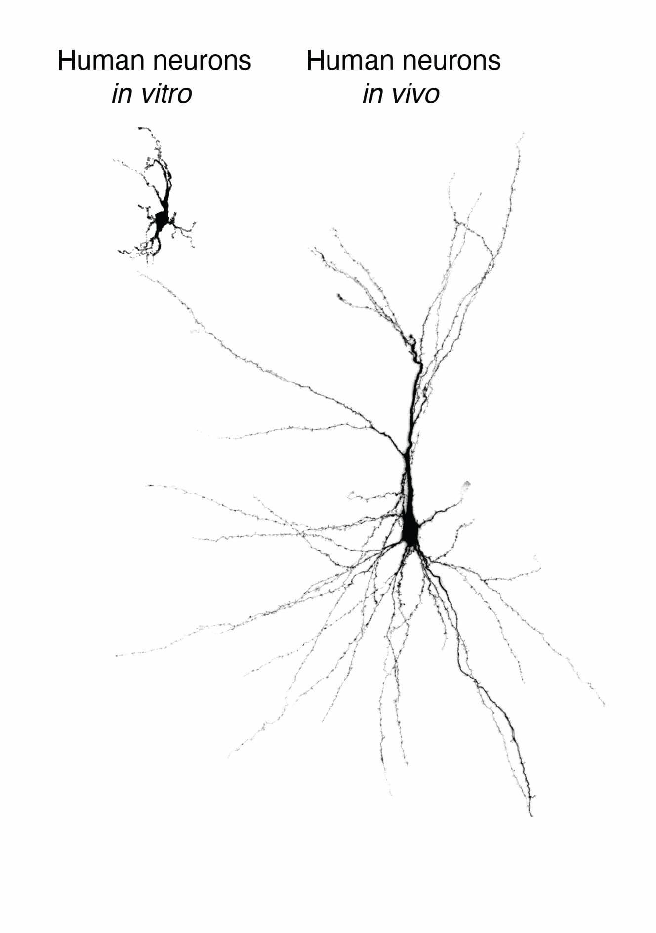 来自干细胞的重建人类神经元，在培养皿中维系并移植到大鼠大脑皮层中。图片来源于斯坦福大学。