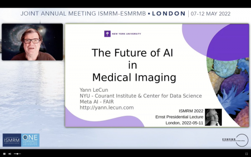 医疗 mr是什么ISMRM2022展示MR领域新趋势：AI赋能医学影像成核心关键词_https://www.jmylbn.com_新闻资讯_第3张