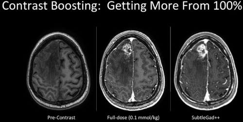 医疗 mr是什么ISMRM2022展示MR领域新趋势：AI赋能医学影像成核心关键词_https://www.jmylbn.com_新闻资讯_第6张
