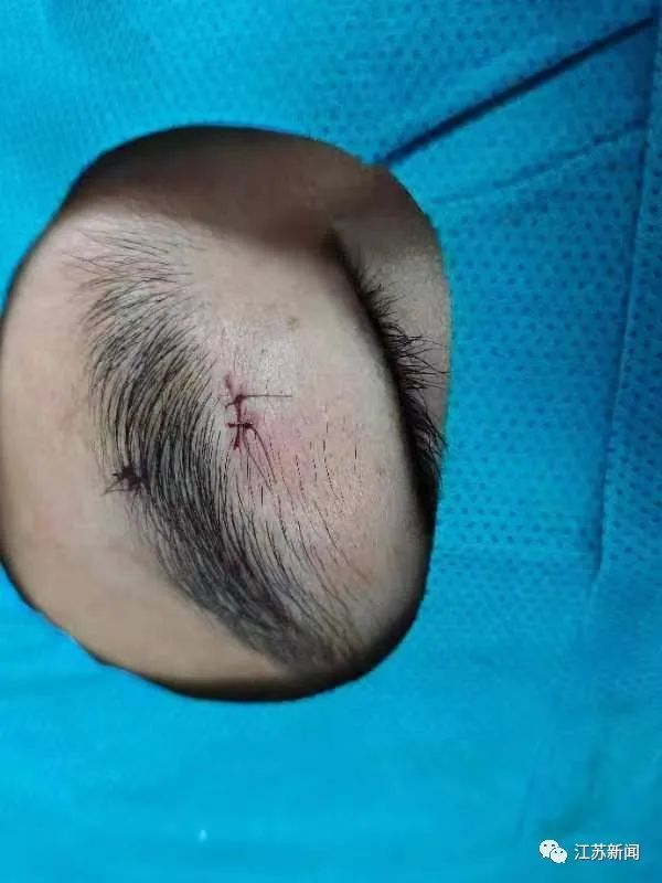 学到了吗（男子被钓起来了）钓鱼被拉下水搞笑视频，可怕！男子钓鱼却将鱼钩甩到…，鱼钩草，